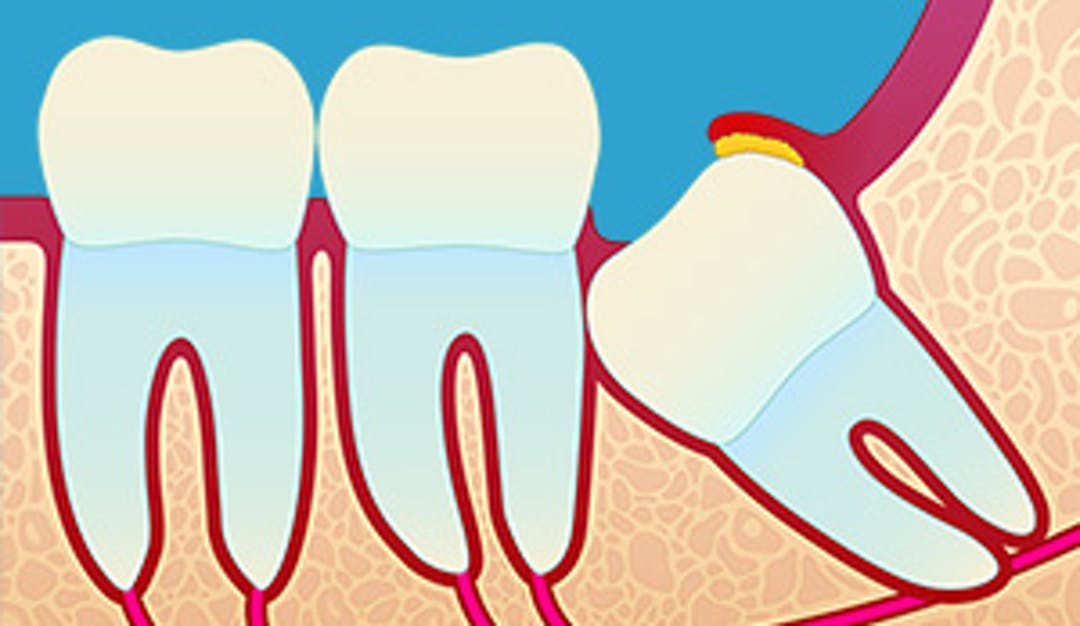 Visdomstenner_w300__56ff7cfdf655ca741cc781ab8c33455c-1